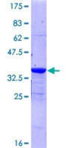 Novus Biologicals Recombinant Human PKIG GST (N-Term) Protein 25 &mu;g | Buy Online | Novus Biologicals&trade; | Fisher Scientific