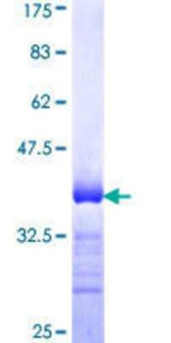 Novus Biologicals Recombinant Human PKIG GST (N-Term) Protein 25 &mu;g | Buy Online | Novus Biologicals&trade; | Fisher Scientific