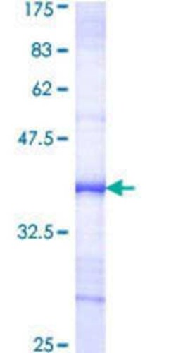 Novus Biologicals Recombinant Human HBO1 GST (N-Term) Protein 25 &mu;g | Buy Online | Novus Biologicals&trade; | Fisher Scientific
