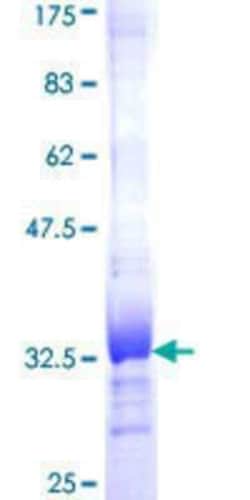 Novus Biologicals Recombinant Human HHLA3 GST (N-Term) Protein 25 &mu;g | Buy Online | Novus Biologicals&trade; | Fisher Scientific