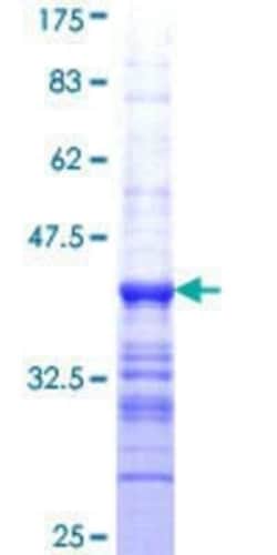 Novus Biologicals Recombinant Human BVES GST (N-Term) Protein 10 &mu;g | Buy Online | Novus Biologicals&trade; | Fisher Scientific