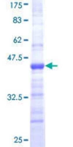 Novus Biologicals Recombinant Human Coronin-1a GST (N-Term) Protein 25 &mu;g | Buy Online | Novus Biologicals&trade; | Fisher Scientific