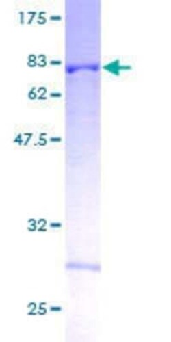 Novus Biologicals Recombinant Human HYPE GST (N-Term) Protein 10 &mu;g | Buy Online | Novus Biologicals&trade; | Fisher Scientific