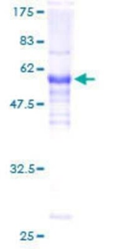 Novus Biologicals Recombinant Human LDB3 GST (N-Term) Protein 10 &mu;g | Buy Online | Novus Biologicals&trade; | Fisher Scientific