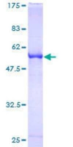 Novus Biologicals Recombinant Human RABL2B GST (N-Term) Protein 25 &mu;g | Buy Online | Novus Biologicals&trade; | Fisher Scientific