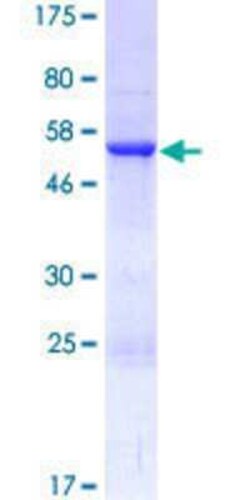Novus Biologicals Recombinant Human RABL2A GST (N-Term) Protein 10 &mu;g | Buy Online | Novus Biologicals&trade; | Fisher Scientific