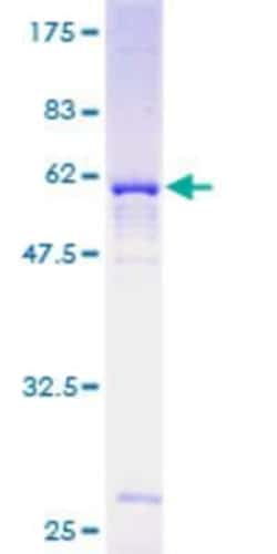 Novus Biologicals Recombinant Human NUDT6 GST (N-Term) Protein 10 &mu;g | Buy Online | Novus Biologicals&trade; | Fisher Scientific