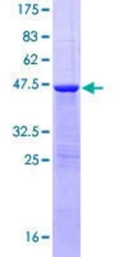 Novus Biologicals Recombinant Human FAM107A GST (N-Term) Protein 10 &mu;g | Buy Online | Novus Biologicals&trade; | Fisher Scientific