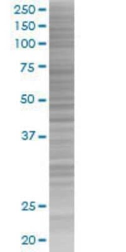 Novus Biologicals&trade;&nbsp;FAM107A 293T Cell Transient Overexpression Lysate