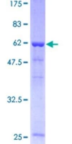 Novus Biologicals Recombinant Human STRAP GST (N-Term) Protein 25 &mu;g | Buy Online | Novus Biologicals&trade; | Fisher Scientific