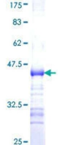 Novus Biologicals Recombinant Human ADAMTS7 GST (N-Term) Protein 10 &mu;g | Buy Online | Novus Biologicals&trade; | Fisher Scientific