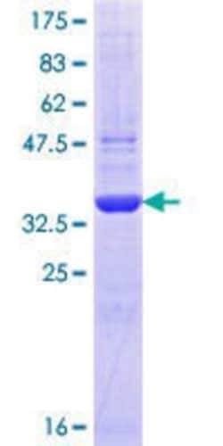 Novus Biologicals Recombinant Human ADAMTS6 GST (N-Term) Protein 25 &mu;g | Buy Online | Novus Biologicals&trade; | Fisher Scientific
