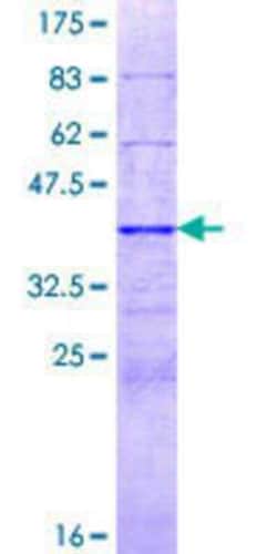 Novus Biologicals Recombinant Human BAZ2A GST (N-Term) Protein 25 &mu;g | Buy Online | Novus Biologicals&trade; | Fisher Scientific