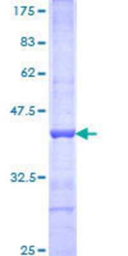 Novus Biologicals Recombinant Human ACF1 GST (N-Term) Protein 25 &mu;g | Buy Online | Novus Biologicals&trade; | Fisher Scientific