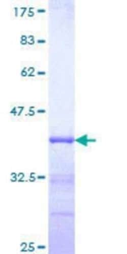 Novus Biologicals Recombinant Human LZTS1 GST (N-Term) Protein 10 &mu;g | Buy Online | Novus Biologicals&trade; | Fisher Scientific