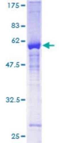 Novus Biologicals Recombinant Human ZNF277 GST (N-Term) Protein 10 &mu;g | Buy Online | Novus Biologicals&trade; | Fisher Scientific