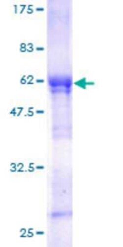 Novus Biologicals Recombinant Human WDR6 GST (N-Term) Protein 25 &mu;g | Buy Online | Novus Biologicals&trade; | Fisher Scientific