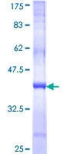 Novus Biologicals Recombinant Human WDR6 GST (N-Term) Protein 25 &mu;g | Buy Online | Novus Biologicals&trade; | Fisher Scientific