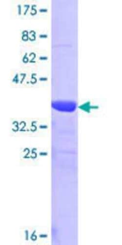 Novus Biologicals Recombinant Human TREH GST (N-Term) Protein 25 &mu;g | Buy Online | Novus Biologicals&trade; | Fisher Scientific