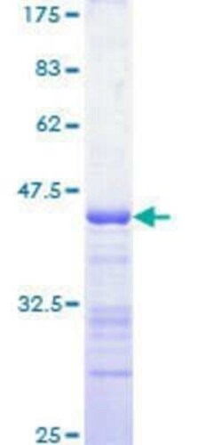 Novus Biologicals Recombinant Human MAP4K5 GST (N-Term) Protein 10 &mu;g | Buy Online | Novus Biologicals&trade; | Fisher Scientific