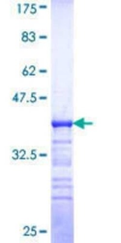 Novus Biologicals Recombinant Human MAP4K1 GST (N-Term) Protein 25 &mu;g | Buy Online | Novus Biologicals&trade; | Fisher Scientific