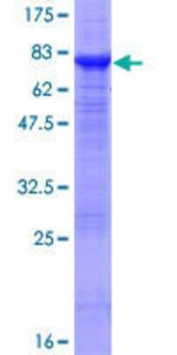 Novus Biologicals Recombinant Human PTENP1 GST (N-Term) Protein 10 &mu;g | Buy Online | Novus Biologicals&trade; | Fisher Scientific