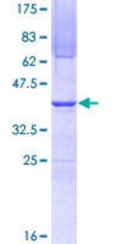 Novus Biologicals Recombinant Human SUPT16H GST (N-Term) Protein 25 &mu;g | Buy Online | Novus Biologicals&trade; | Fisher Scientific