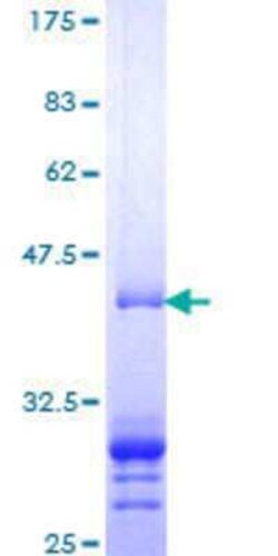 Novus Biologicals Recombinant Human DNA Polymerase iota GST (N-Term) Protein 10 &mu;g | Buy Online | Novus Biologicals&trade; | Fisher Scientific