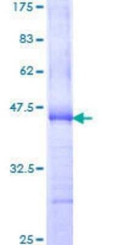 Novus Biologicals Recombinant Human AKAP13 GST (N-Term) Protein 25 &mu;g | Buy Online | Novus Biologicals&trade; | Fisher Scientific