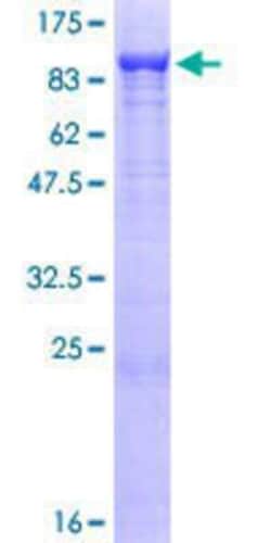 Novus Biologicals&trade;&nbsp;Recombinant Human AKAP10 GST (N-Term) Protein