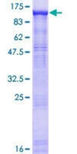 Novus Biologicals Recombinant Human Gemin 3 GST (N-Term) Protein 10 &mu;g | Buy Online | Novus Biologicals&trade; | Fisher Scientific