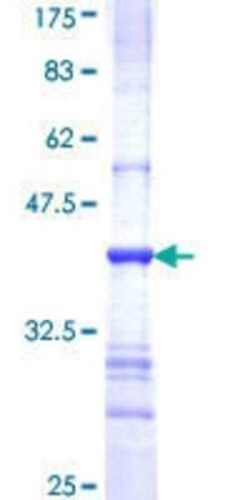 Novus Biologicals Recombinant Human Gemin 3 GST (N-Term) Protein 25 &mu;g | Buy Online | Novus Biologicals&trade; | Fisher Scientific