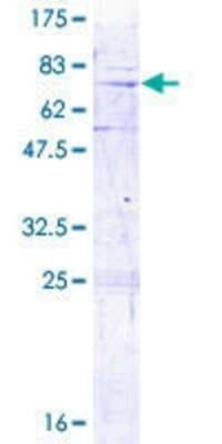 Novus Biologicals Recombinant Human MRPL3 GST (N-Term) Protein 2 &mu;g | Buy Online | Novus Biologicals&trade; | Fisher Scientific
