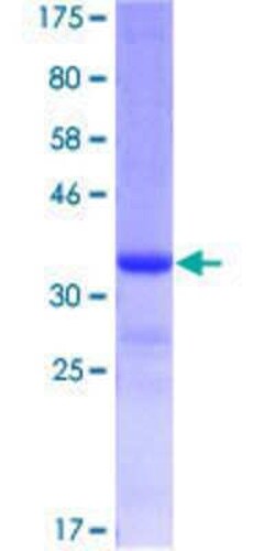 Novus Biologicals Recombinant Human GALNT6 GST (N-Term) Protein 10 &mu;g | Buy Online | Novus Biologicals&trade; | Fisher Scientific