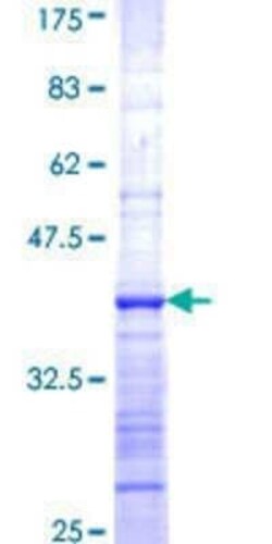 Novus Biologicals Recombinant Human RASSF8 GST (N-Term) Protein 10 &mu;g | Buy Online | Novus Biologicals&trade; | Fisher Scientific