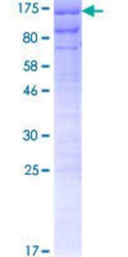 Novus Biologicals Recombinant Human SEC63 GST (N-Term) Protein 2 &mu;g | Buy Online | Novus Biologicals&trade; | Fisher Scientific