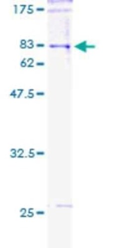 Novus Biologicals Recombinant Human POLG2 GST (N-Term) Protein 10 &mu;g | Buy Online | Novus Biologicals&trade; | Fisher Scientific