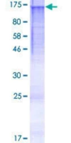 Novus Biologicals Recombinant Human HPS5 GST (N-Term) Protein 25 &mu;g:Proteínas