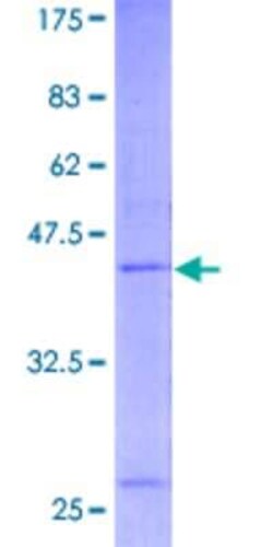 Novus Biologicals Recombinant Human RNF24 GST (N-Term) Protein 25 &mu;g | Buy Online | Novus Biologicals&trade; | Fisher Scientific