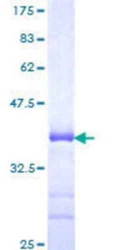 Novus Biologicals Recombinant Human RNF24 GST (N-Term) Protein 10 &mu;g | Buy Online | Novus Biologicals&trade; | Fisher Scientific