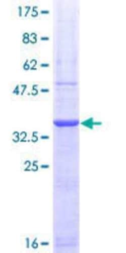 Novus Biologicals Recombinant Human PADI2 GST (N-Term) Protein 10 &mu;g | Buy Online | Novus Biologicals&trade; | Fisher Scientific