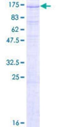 Novus Biologicals Recombinant Human ZHX1 GST (N-Term) Protein 25 &mu;g | Buy Online | Novus Biologicals&trade; | Fisher Scientific