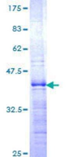 Novus Biologicals Recombinant Human ZHX1 GST (N-Term) Protein 10 &mu;g | Buy Online | Novus Biologicals&trade; | Fisher Scientific