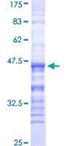 Novus Biologicals Recombinant Human GPR176 GST (N-Term) Protein 25 &mu;g | Buy Online | Novus Biologicals&trade; | Fisher Scientific