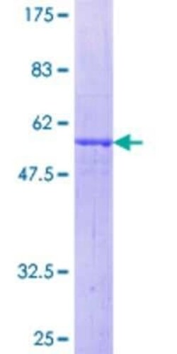 Novus Biologicals Recombinant Human NXPH4 GST (N-Term) Protein 2 &mu;g | Buy Online | Novus Biologicals&trade; | Fisher Scientific