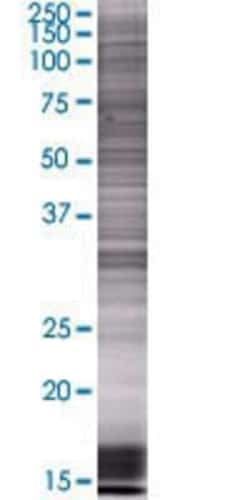 Novus Biologicals NXPH4 293T Cell Transient Overexpression Lysate 0.1 mL | Buy Online | Novus Biologicals&trade; | Fisher Scientific