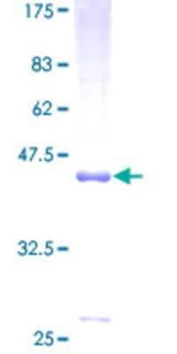 Novus Biologicals Recombinant Human DCTN3 GST (N-Term) Protein 25 &mu;g | Buy Online | Novus Biologicals&trade; | Fisher Scientific