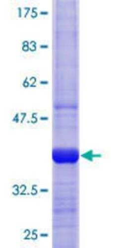 Novus Biologicals Recombinant Human Exportin-T GST (N-Term) Protein 25 &mu;g | Buy Online | Novus Biologicals&trade; | Fisher Scientific