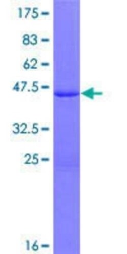 Novus Biologicals Recombinant Human SP140 GST (N-Term) Protein 10 &mu;g | Buy Online | Novus Biologicals&trade; | Fisher Scientific