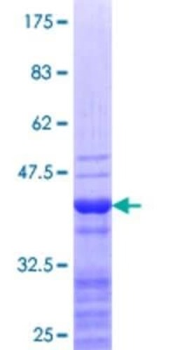 Novus Biologicals Recombinant Human SP140 GST (N-Term) Protein 25 &mu;g | Buy Online | Novus Biologicals&trade; | Fisher Scientific